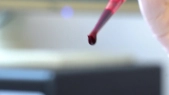 thumbnail of medium Liquid Biopsy – Tumoren mittels Blutprobe auf der Spur 